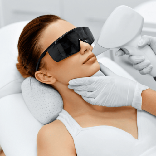 Upper Lips Laser Hair Removal