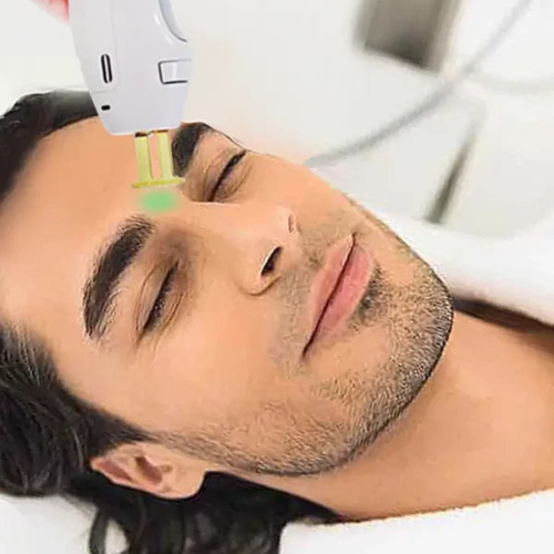 Men's Centre Brow Laser Hair Removal