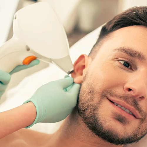 Men's Ears Laser Hair Removal