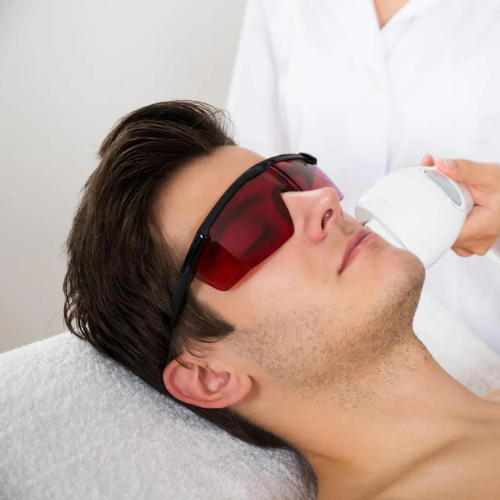 Men's Full Beard Laser Hair Removal