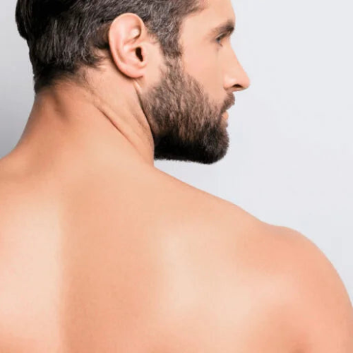 Men's Shoulders Laser Hair Removal