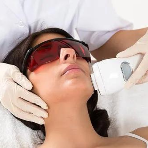 Sides of Face Laser Hair Removal